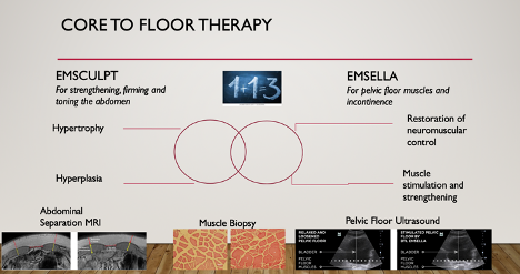 Emsculpt and Emsella Core to Floor therapy Infographics