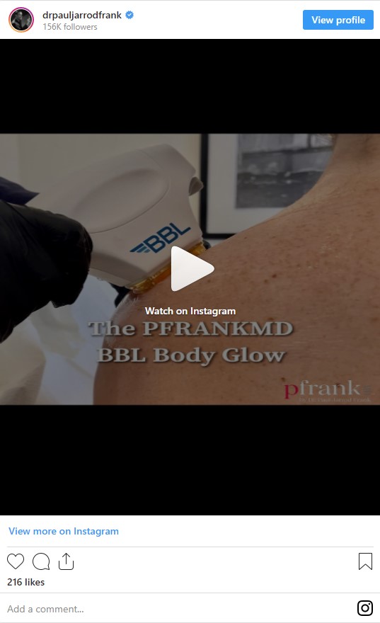 BBL Body Glow treatment video by Dr. Paul Jarrod Frank of PFRANKMD in New York City, NY
