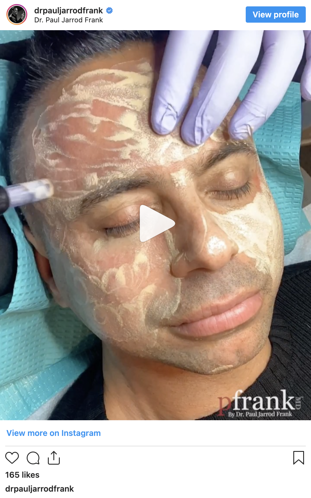 BB Glow-Up Facial video by Dr. Paul Jarrod Frank of PFRANKMD in New York City, NY