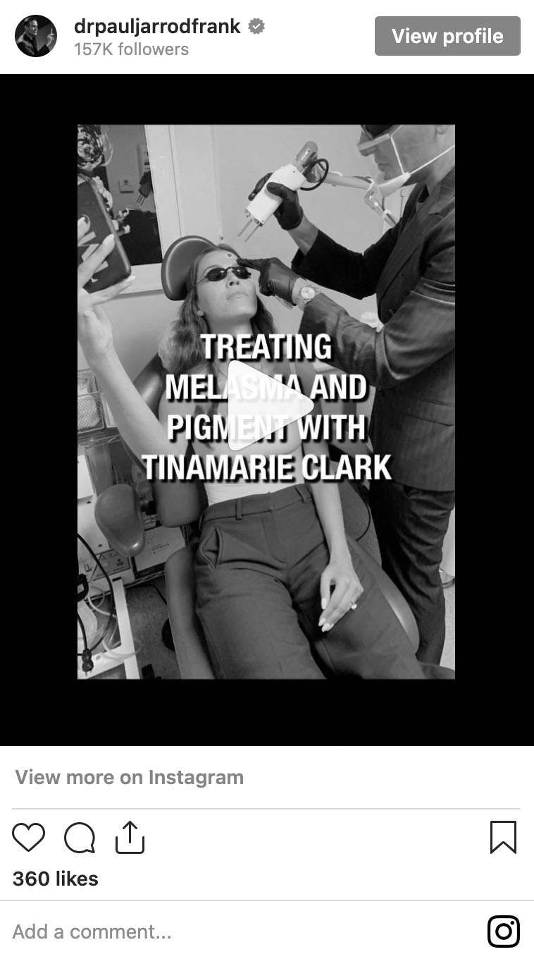 Dr. Paul Jarrod Frank of PFRANKMD in New York City treating melasma and pigmentation with Tinamarie Clark