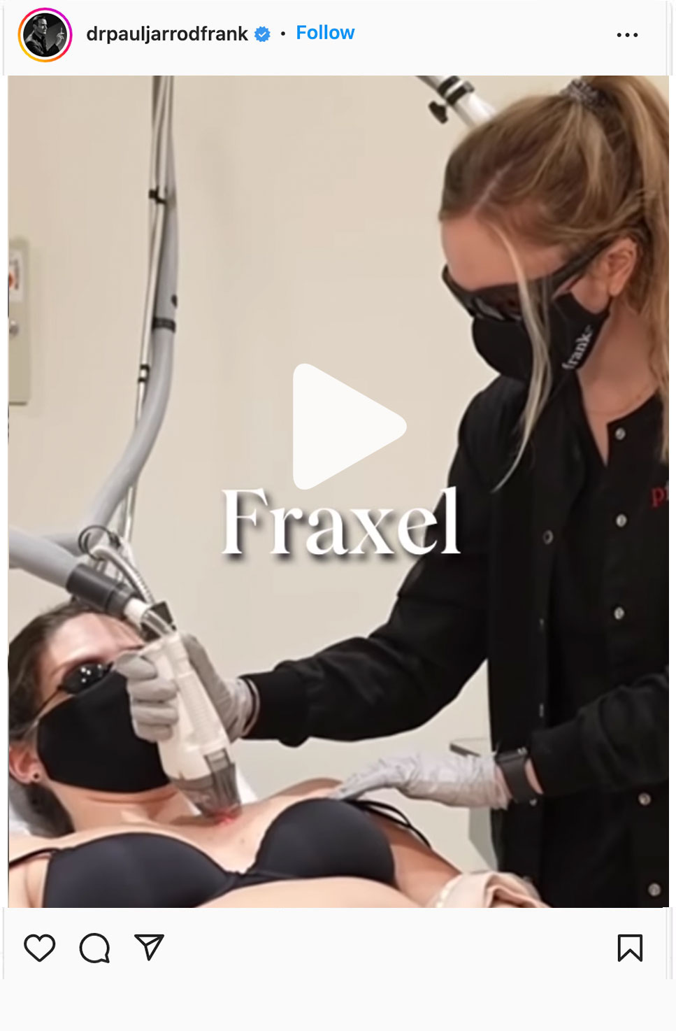 fraxel treatments